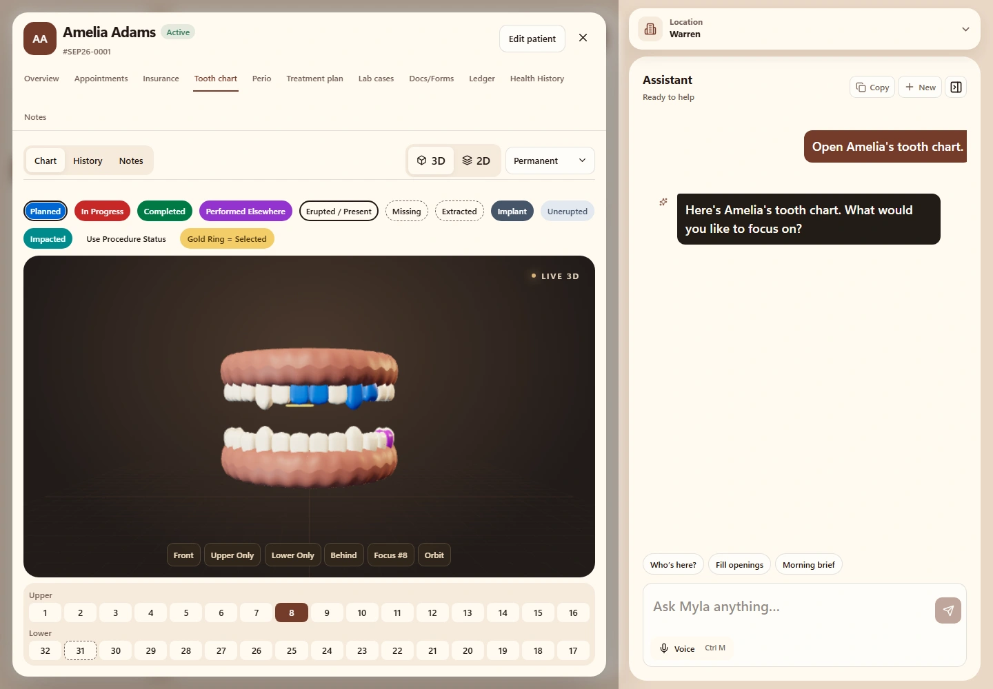 Myla PMS tooth chart with the assistant pane open alongside it, showing a sample request to open Amelia's chart and Myla's reply
